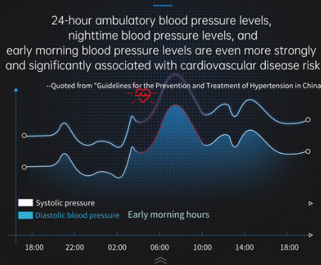 Blood Pressure Monitor Watch